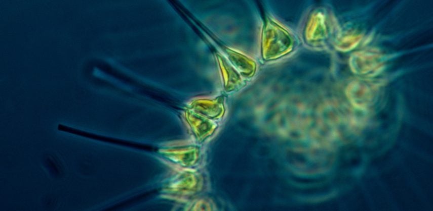 Phytoplankton under a microscope