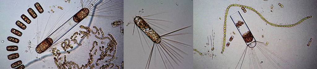 Composite of three images of Antarctic phytoplankton under the microscope